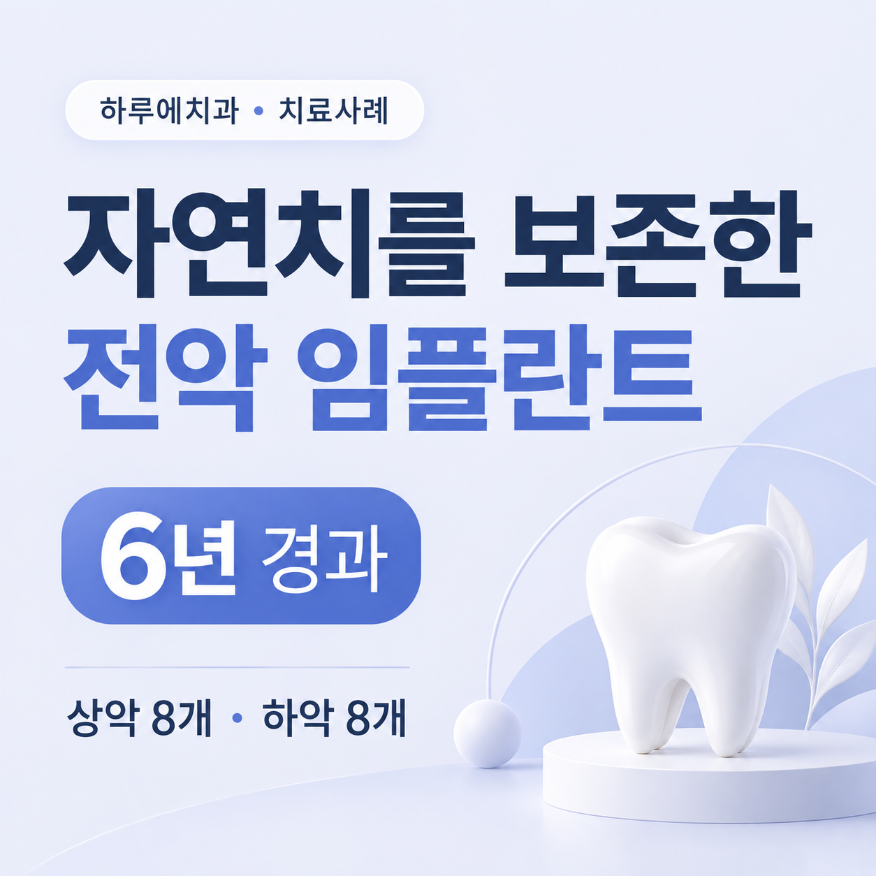 자연치를 보존한 전악 임플란트 치료 후 6년 경과 증례 안내